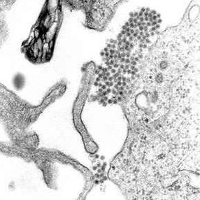 Dengue in Santa Fe: 8,326 Cases and 7 Deaths Confirmed During the Season