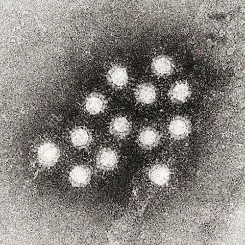 LI Jersey Mike’s worker tests positive for hepatitis A as officials warn customers could be at risk